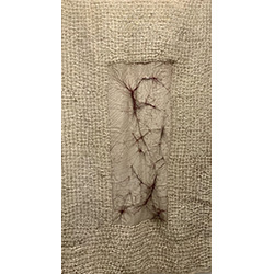 Threading the threads